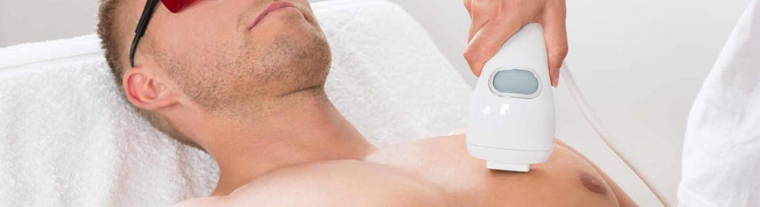 Est-ce qu’il y a une différence entre l’épilation masculine et féminine ?